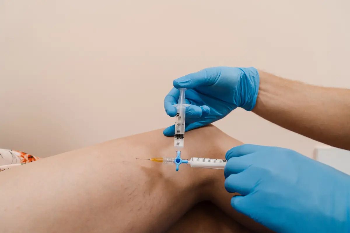 Is Sclerotherapy Vein Treatment Effective for Varicose and Spider Veins?